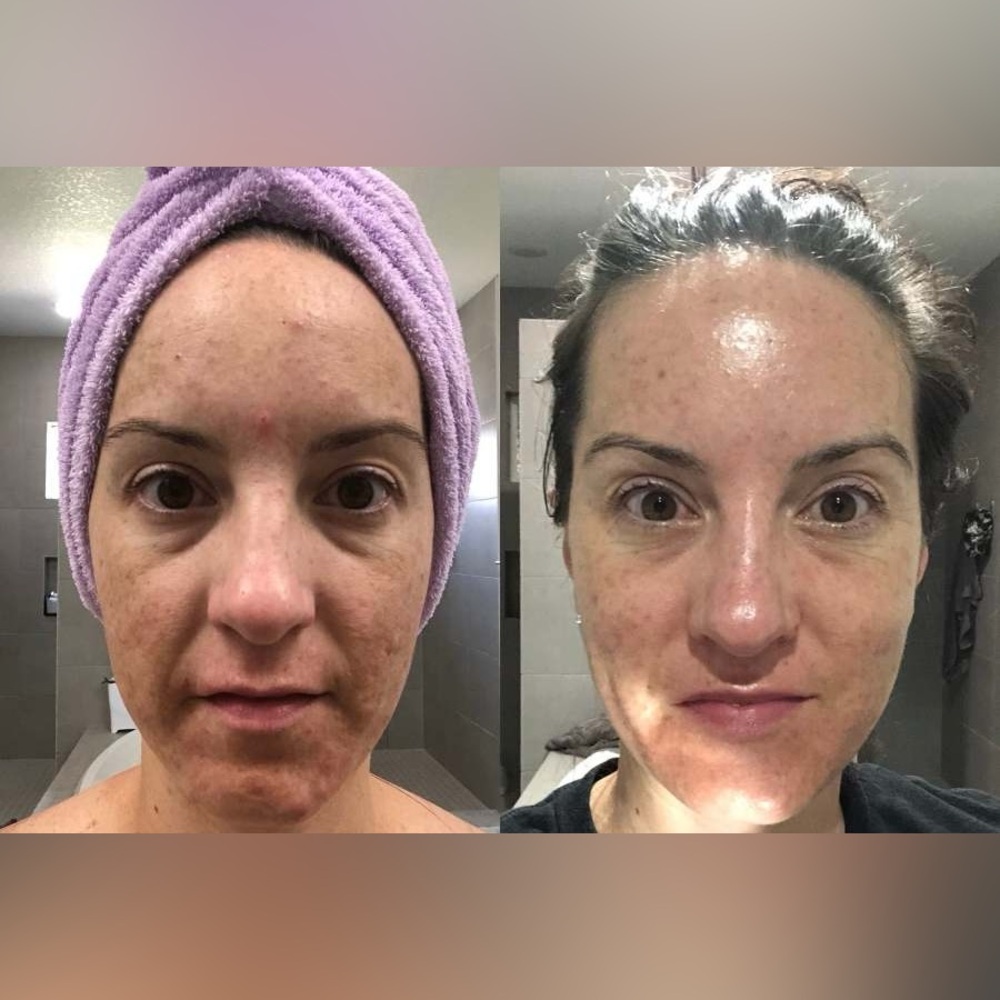 Biologique Recherche Masque VIP O2 - Picture 3 of 3